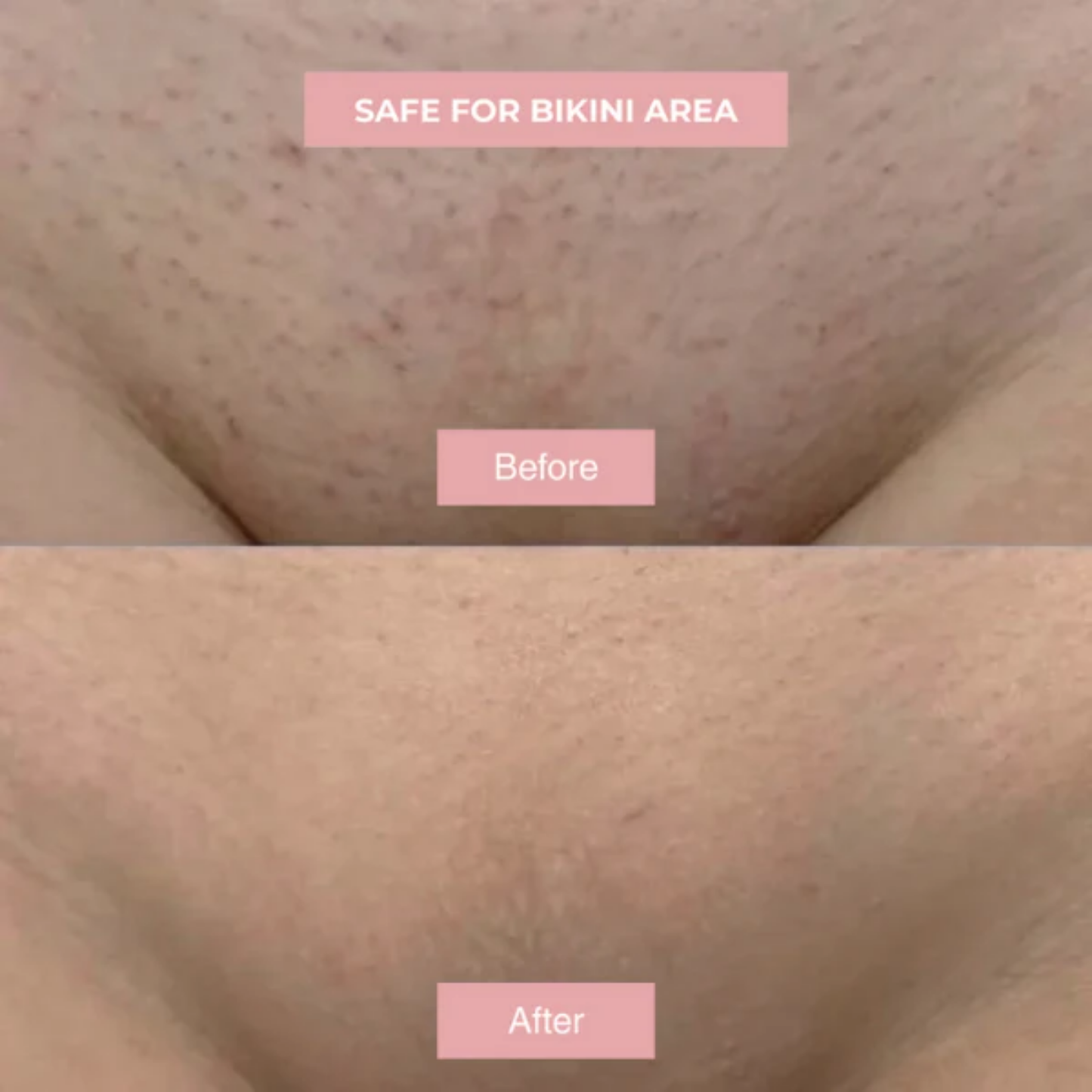 Novira™- Cyperus Rotundus Skin Serum
