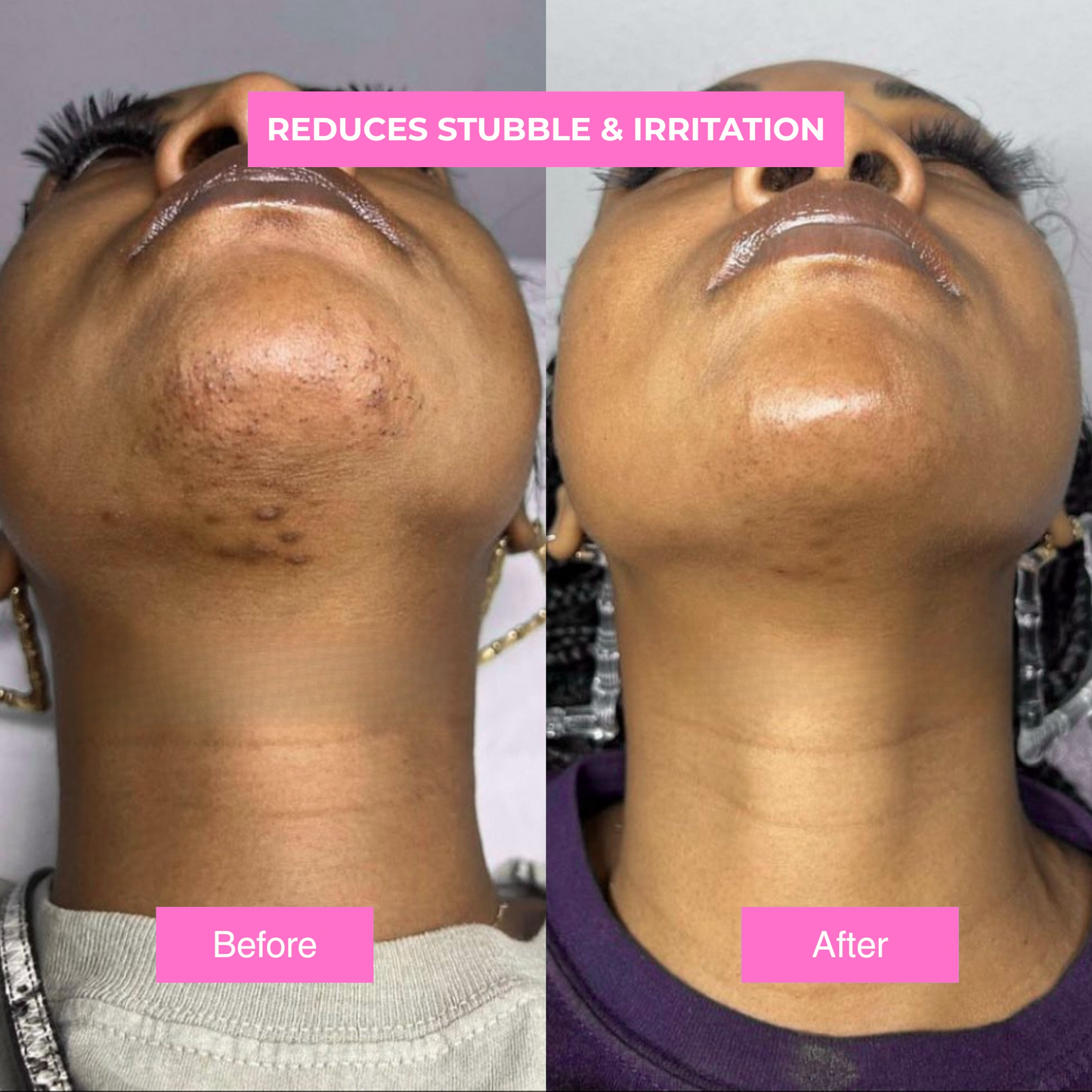 Novira™- Cyperus Rotundus Skin Serum